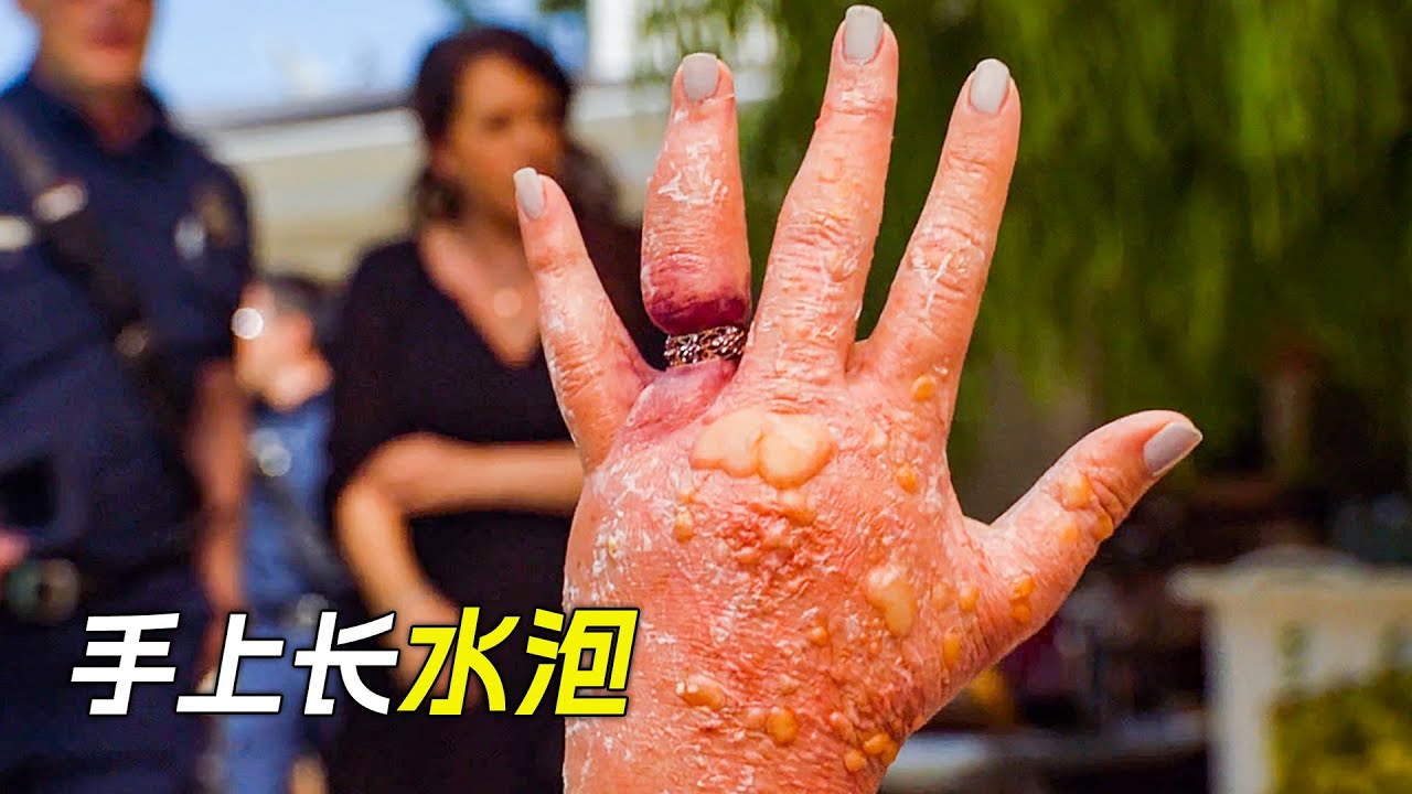 女人對戒指過敏，戴上後手上長出了水泡，科幻，奇幻，電影，解說，獵奇，冒險，救援，短片，short film
