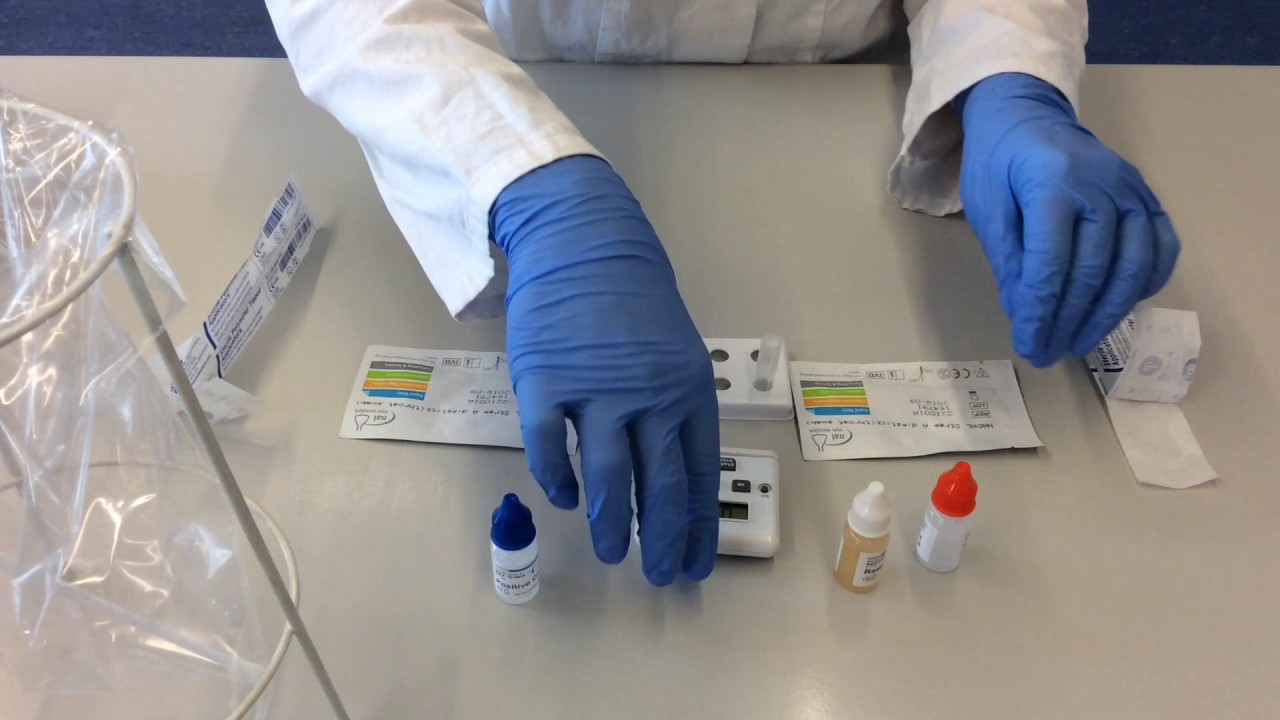 Strep-A-Schnelltest