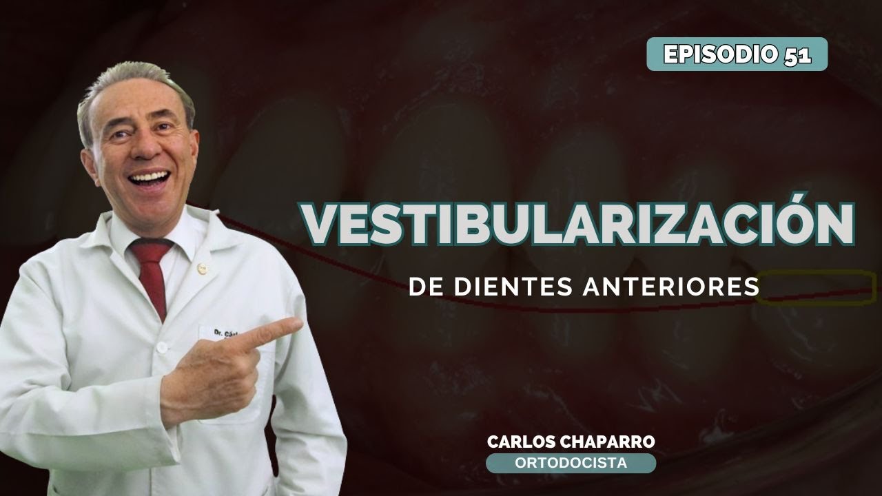 VESTIBULARIZACIÓN DE DIENTES ANTERIORES - EPISODIO 51