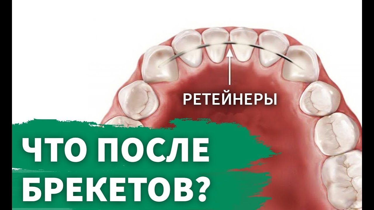 Ретенционный период  Что это и как долго длится?