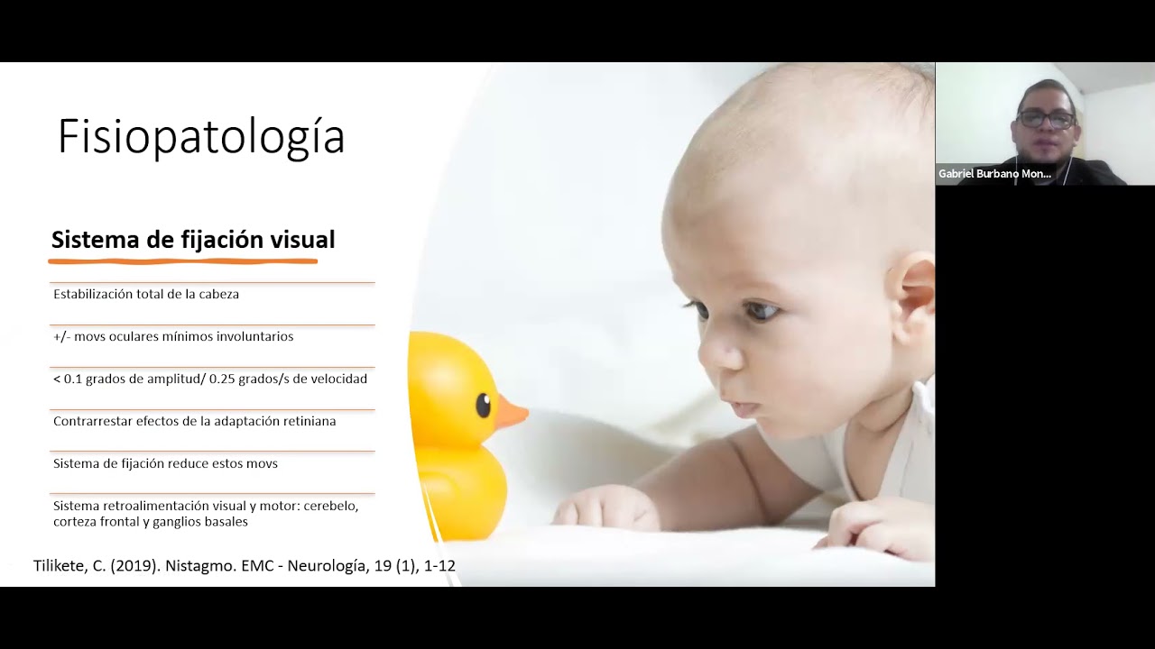 Nistagmus y Albinismo ocular Dr. Gabriel Burbano