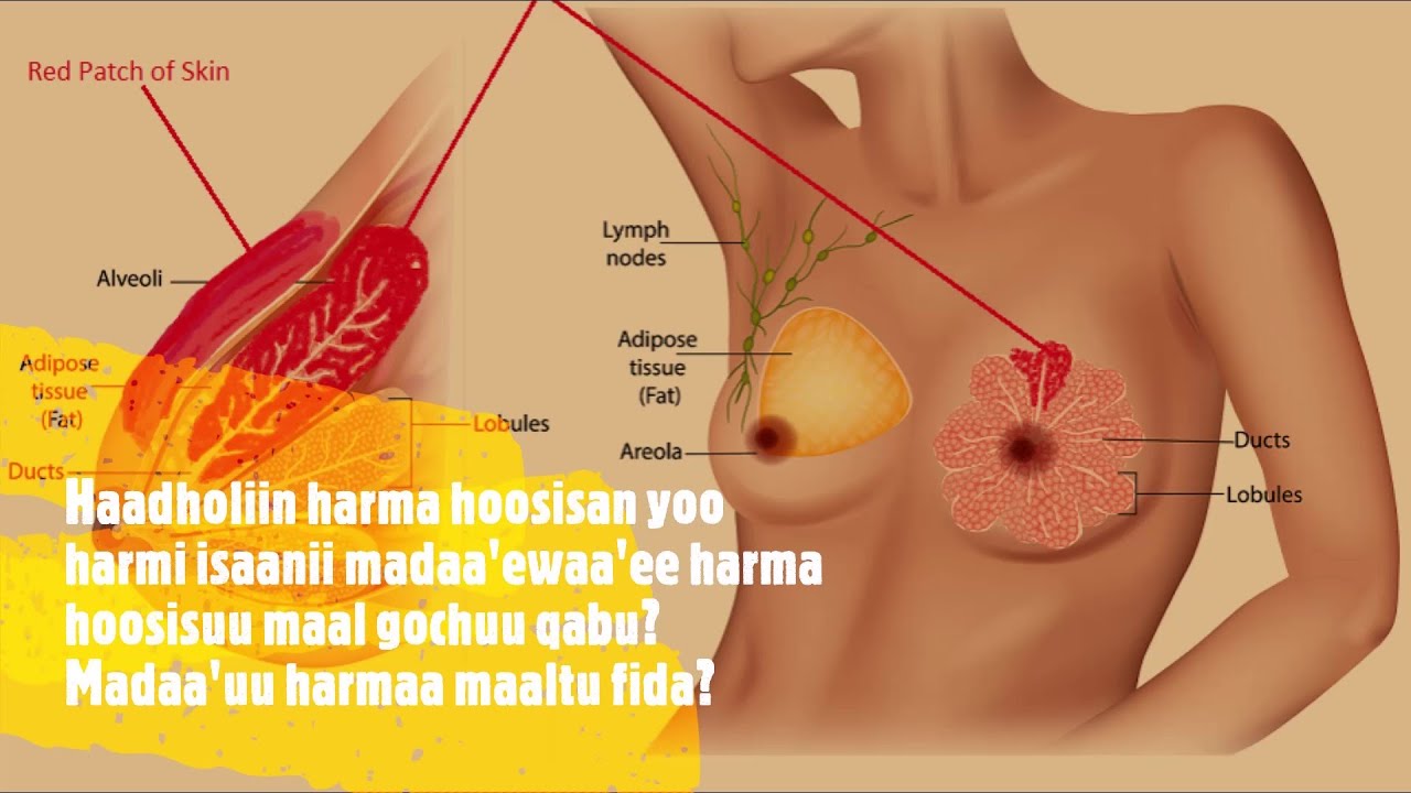 Madaa’uu harma haadha daa’ima harma hoosiftuu - kan haadholiin beekuu qaban!