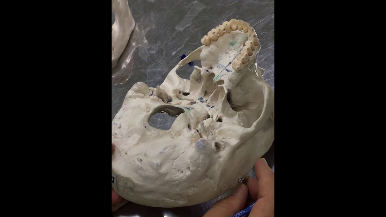 Practical osteology  5 ( skull , norma  basalis externa ), by Dr. Wahdan