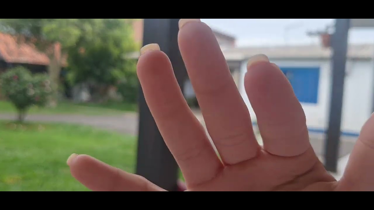 Asmr caseiro na rua| tapping na tela, sons de boca, hands sounds 