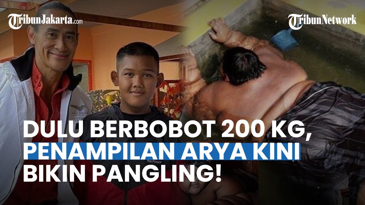 Bikin Pangling Netizen, Inilah Penampilan Terbaru Arya Permana Bocah Obesitas 200 Kg