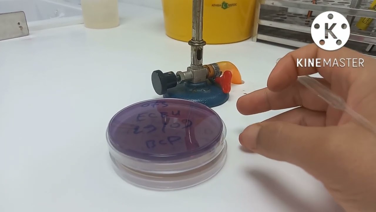 les étapes d'un examen cytobactériologique d'urine ( ECBU )   /طريقة تحليل عينة البول بالتفصيل