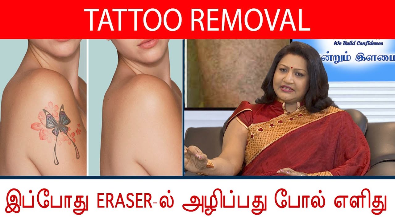 TATTOO-வை நிரந்தரமாக மறையவைக்க முடியும்! | Laser Tattoo Removal | Dr. Praba Reddy | Tamil