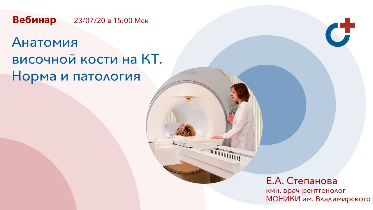 Анатомия височной кости на КТ. Норма и патология.