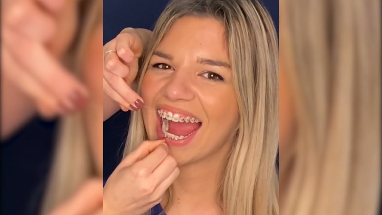 Jelena_Offline - Prali ste zube čitav život pogrešno! Saznajte i ZAŠTO
