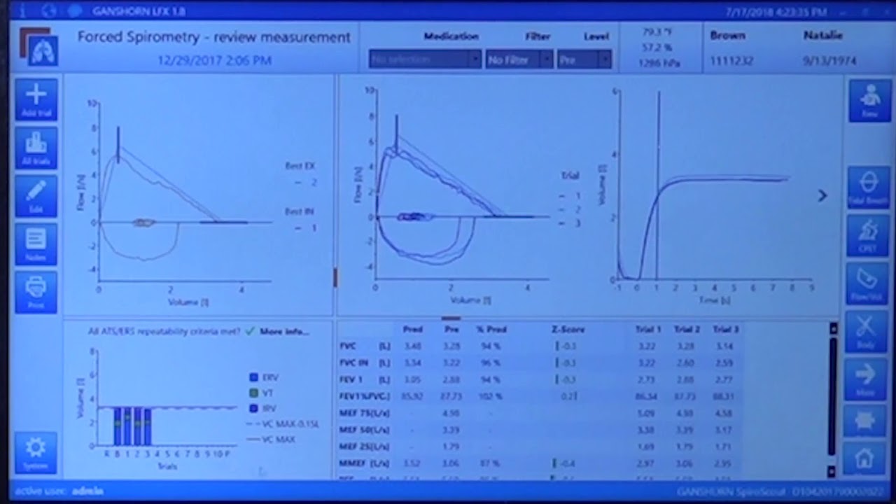 Spirometer SCHILLER Spiroscout - (Basic Usage Tutorial) #spirometer