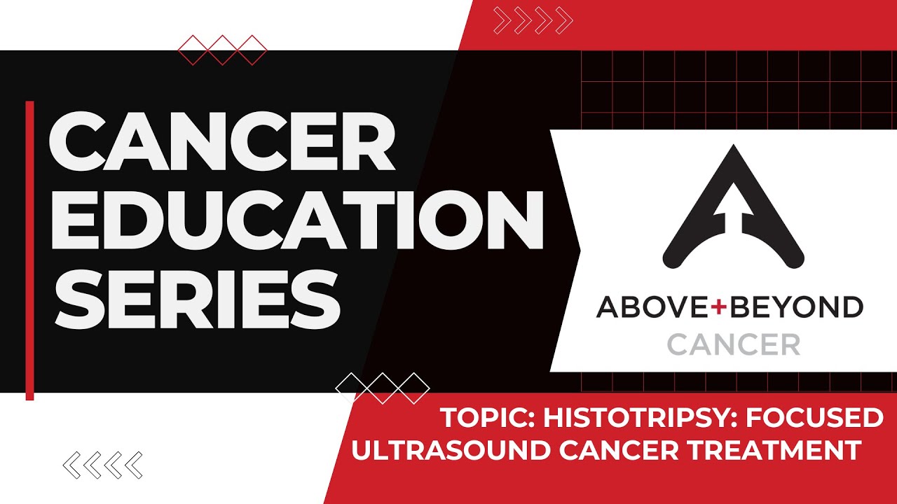 Histotripsy: Focused Ultrasound Cancer Treatment!