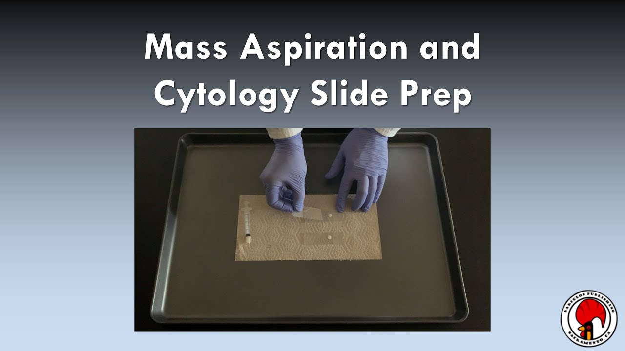 Mass Aspiration and Cytology Slide Prep