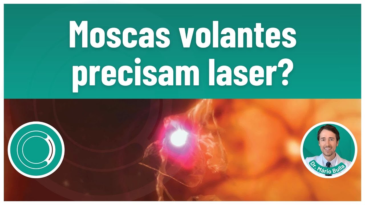 Moscas volantes precisam laser?