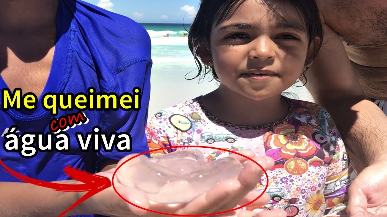 BIG BROTHER DA DUDA  - MEU CARNAVAL  - ME QUEIMEI COM ÁGUA VIVA