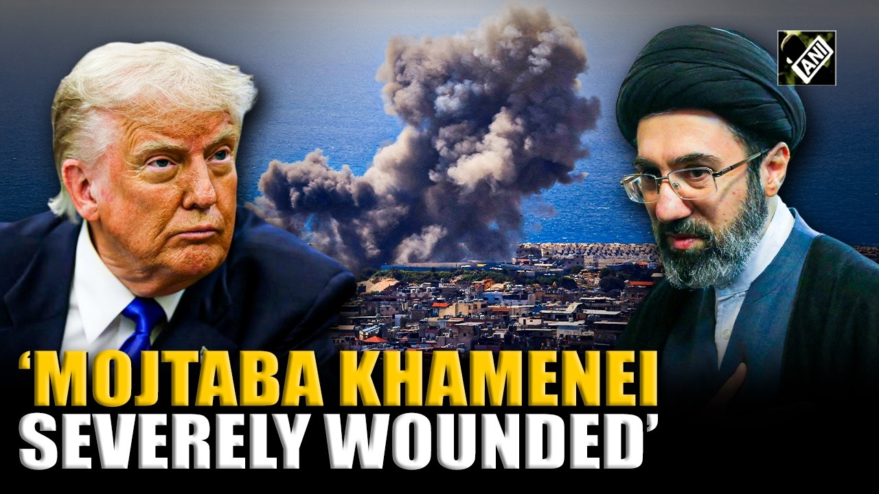 Iran's new Supreme Leader Mojtaba Khamenei has severe & disfiguring wounds, says Report