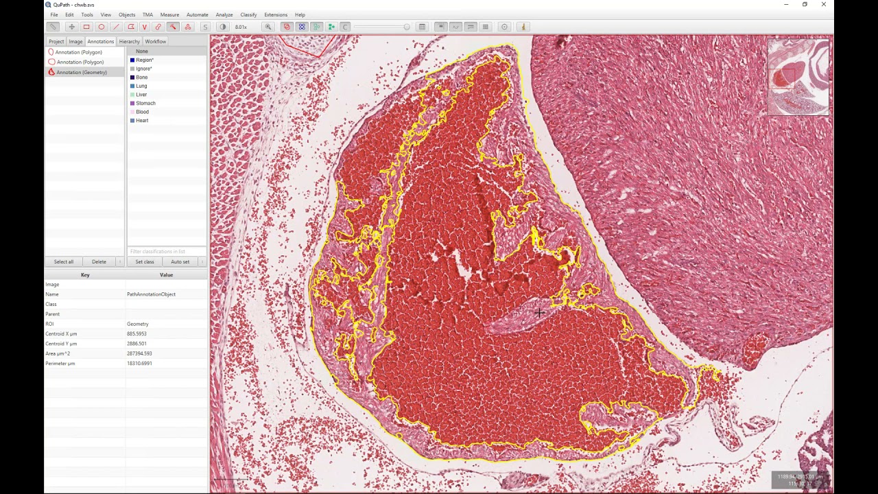 Tutorial - Using SCiLS Lab and QuPath to integrate mass spectrometry imaging with histology