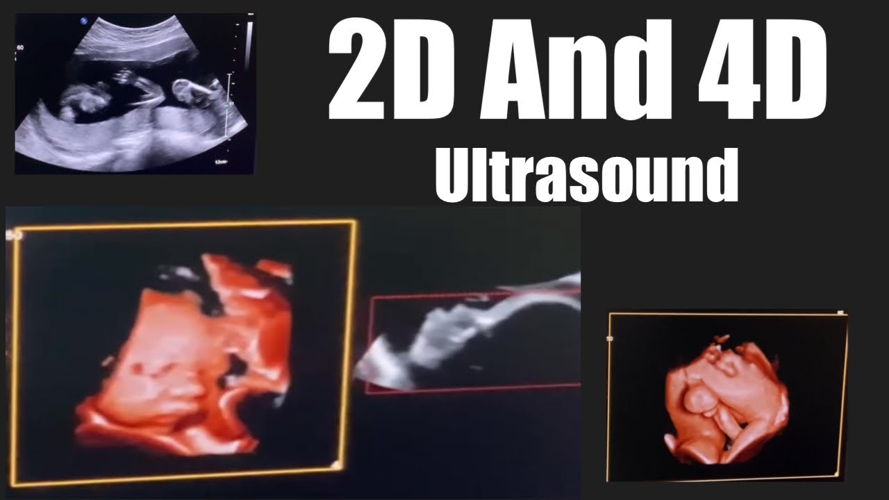2D And 4D Ultrasound pregnancy l Baby Face and Hand 