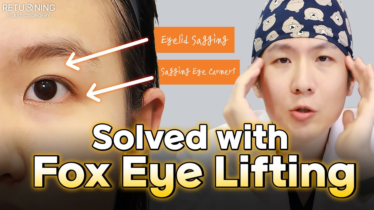 Sagging Eyelids & Droopy Corners? Solved with Fox Eye Lifting!