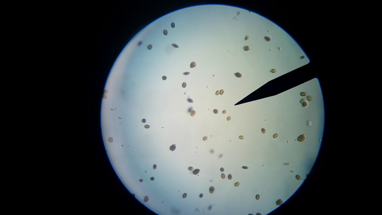 Ostreopsis and Prorocentrum