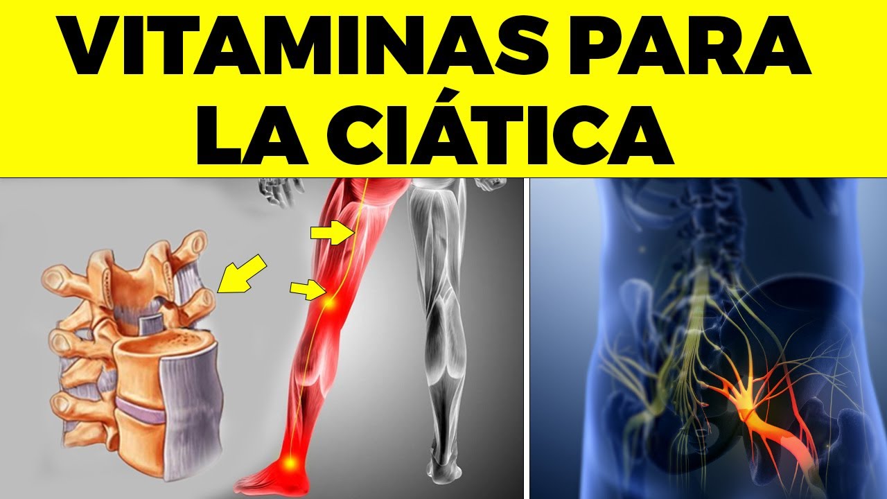 6 VITAMINAS OBLIGATORIAS para LA CIÁTICA o dolor del nervio ciático