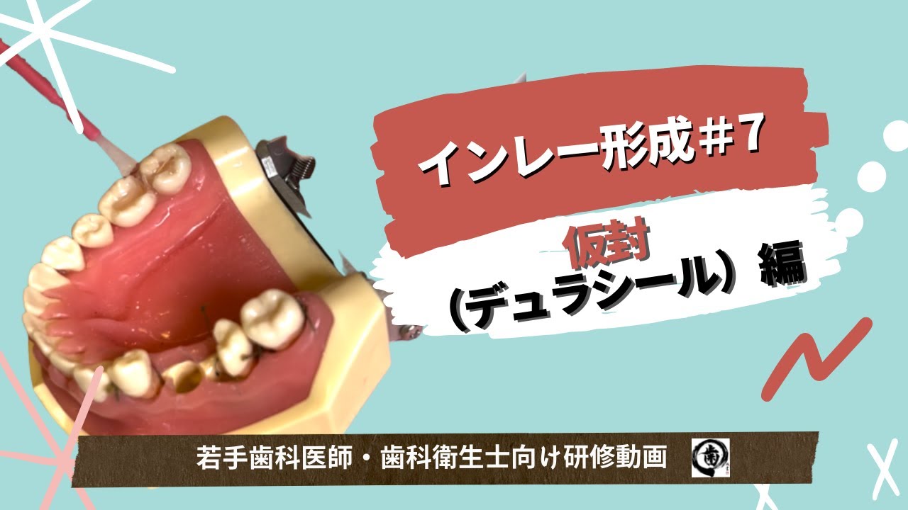 インレー形成＃7「仮封（デュラシール）編」