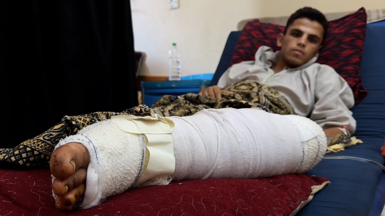 إبراهيم أبو زيد يتلقى الرعاية الطبية في مستشفى ناصر بعد إصابته في رفح أثناء بحثه عن الحطب