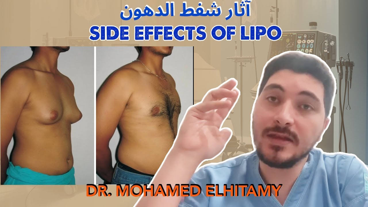 الآثار الجانبية لشفط الدهون: الأسباب والحلول | Liposuction Side Effects Causes & Solutions