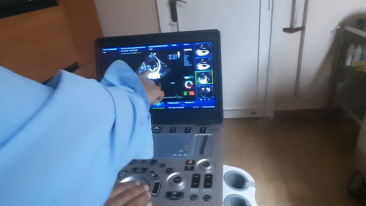 Mindray M9  Tissue tracking hands on