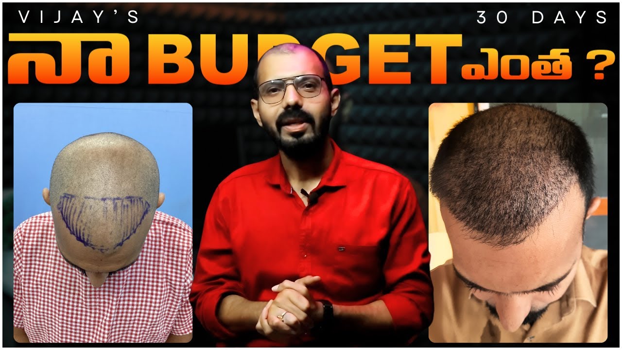 #AskDrJohnWatts | నా BUDGET ఎంత ? | Hair Specialist Explains