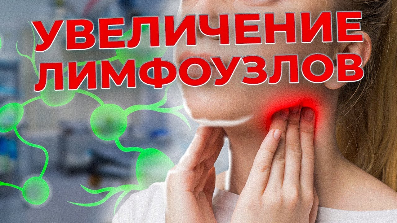 Почему увеличиваются ЛИМФОУЗЛЫ! Лимфоденопатия. Как оценить лимфоузлы самостоятельно. #лимфа #отеки
