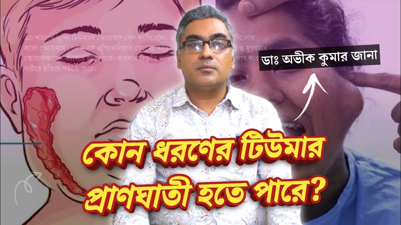 মুখমণ্ডলে টিউমারের লক্ষণ ও উপসর্গ কী কী? | টিউমার মানেই কি ক্যান্সার?| টিউমার থেকে ক্যান্সারের লক্ষণ