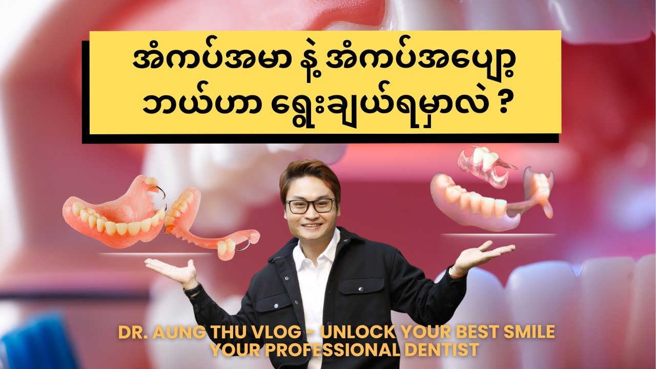 အံကပ်အမာ နဲ့ အံကပ်အပျော့ ဘယ်ဟာရွေးချယ်ရမှာလဲ ?