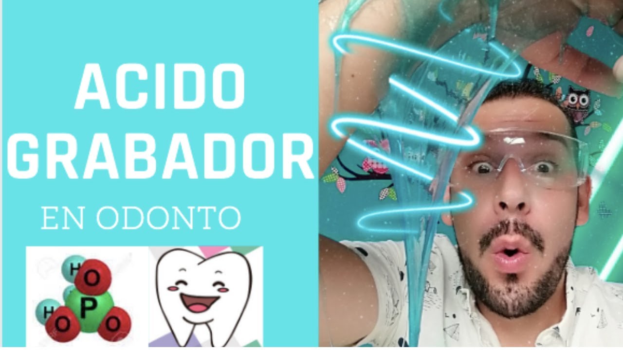 ACIDO GRABADOR EN ODONTOLOGIA!!
