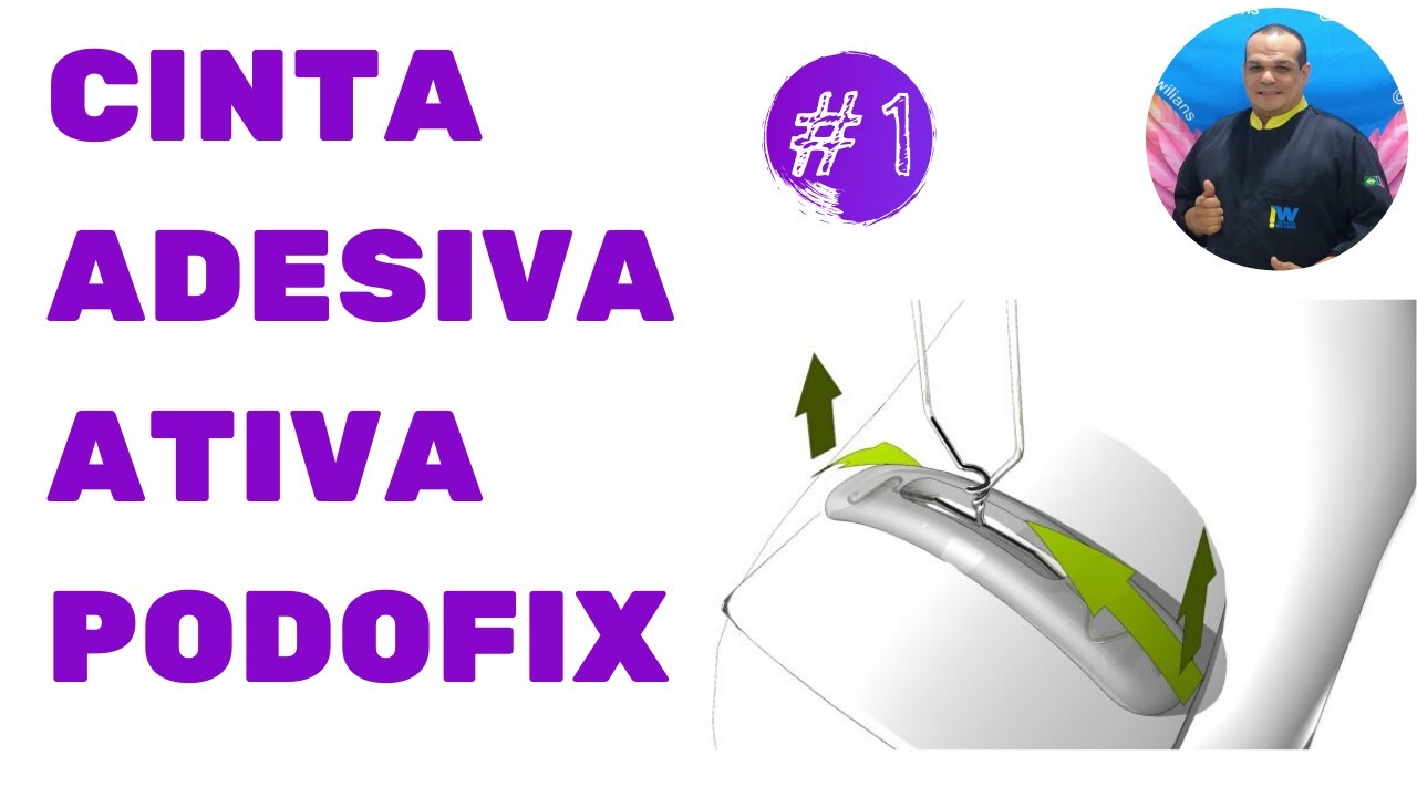 PODOFIX (PARTE 1)