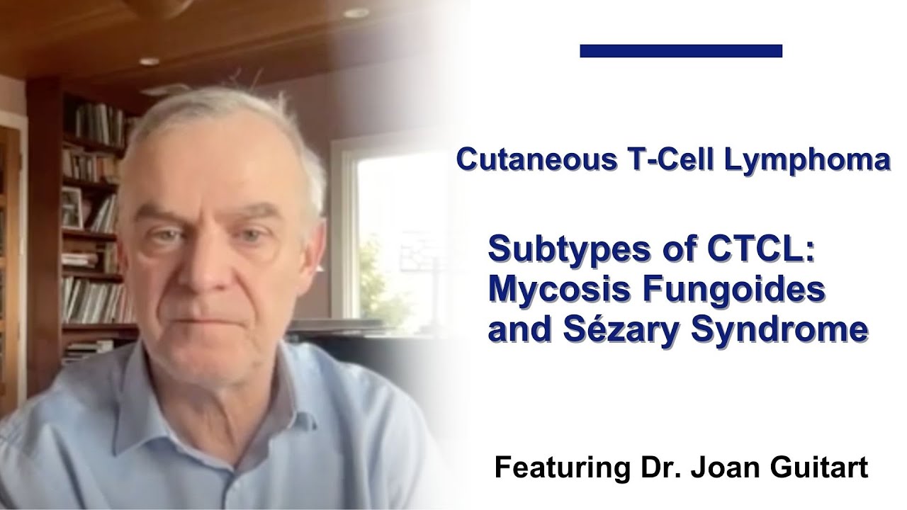 Subtypes of CTCL: Mycosis Fungoides and Sézary Syndrome (Full Interview)