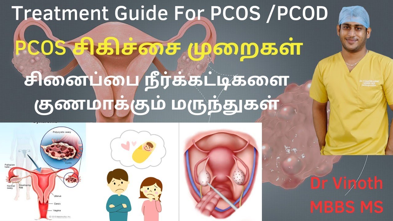 PCOS சிகிச்சை முறைகள்|PCOS treatment|How to reverse PCOS|PCOS permanent relief|PCOS diet|PCOD cure
