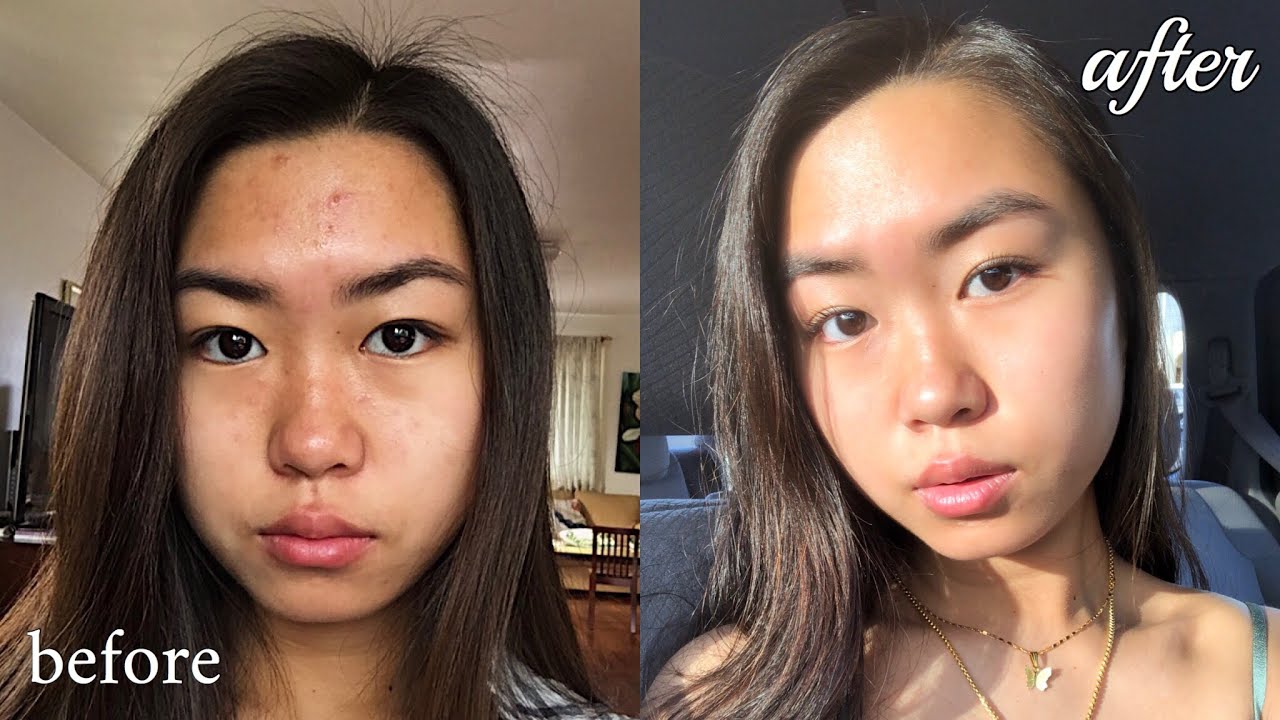 my skincare routine that cured my acne for good (non spons) | summer 2019