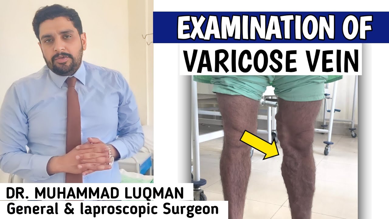 Examination of varicose veins