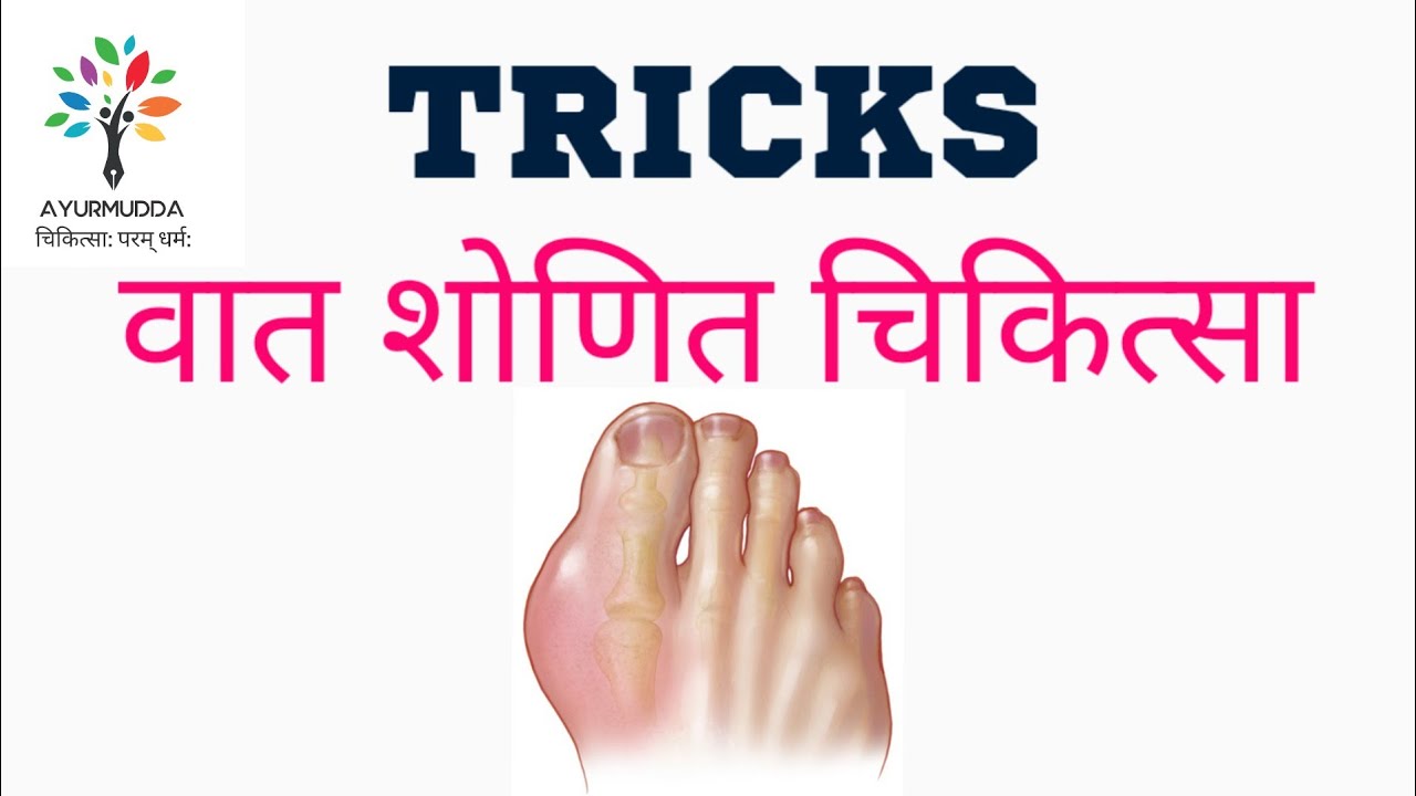 Tricks to learn वातशोणित चिकित्सा || Ayurveda || Charak samhita || BAMS || kayachikitsa || AIAPGET