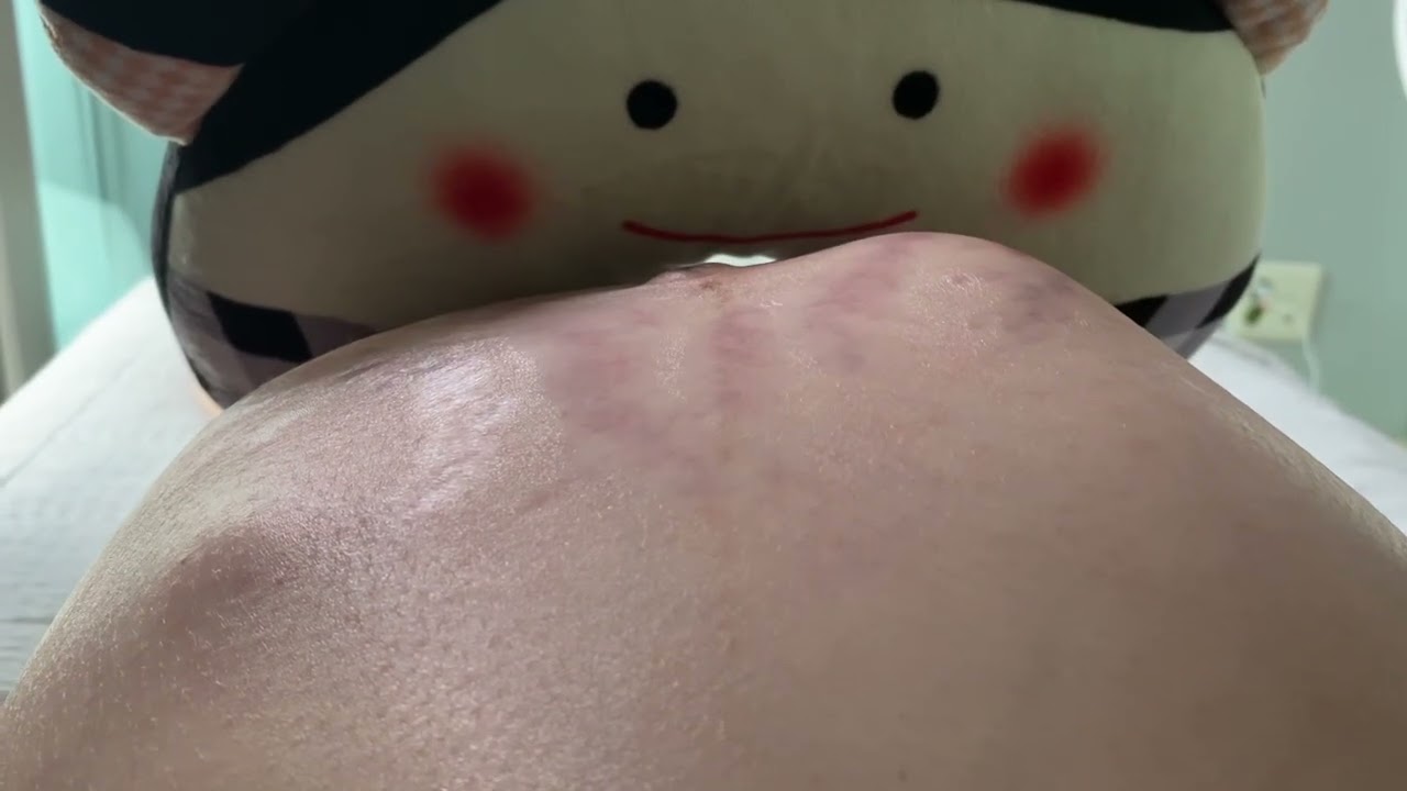 쌍둥이 태동