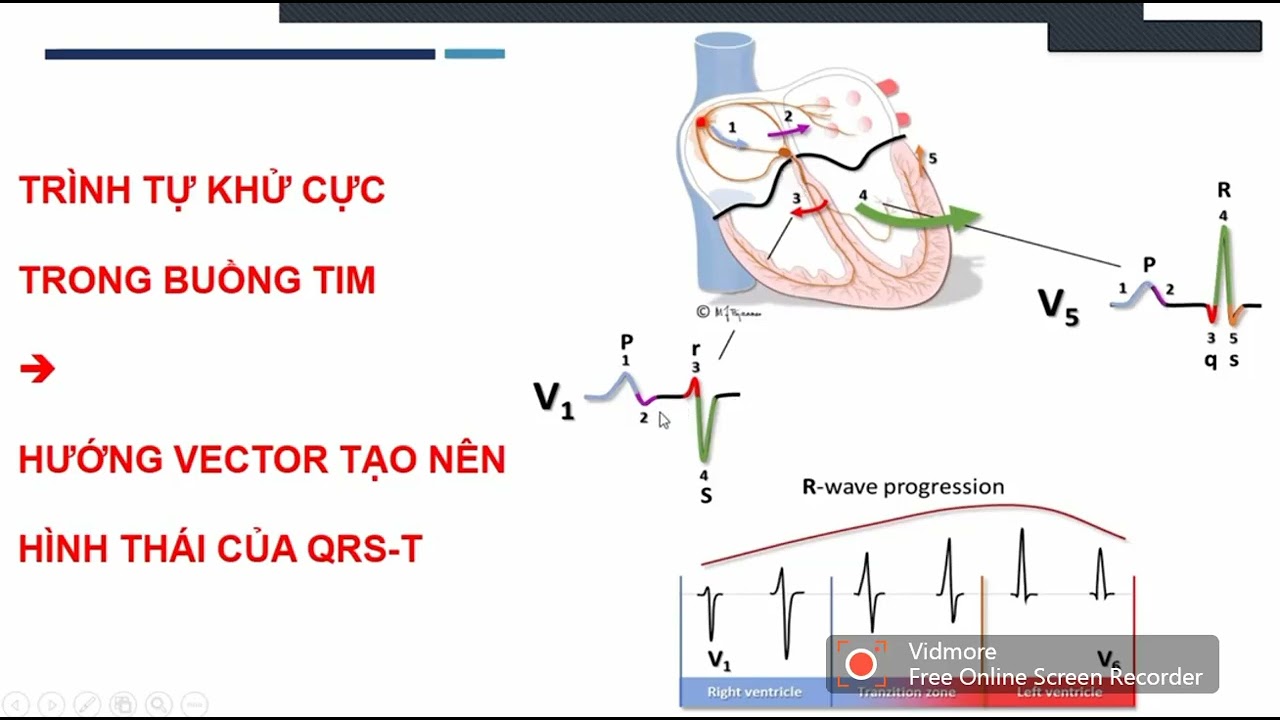 ECG BLOCK DẪN TRUYỀN NỘI THẤT | Phần 2