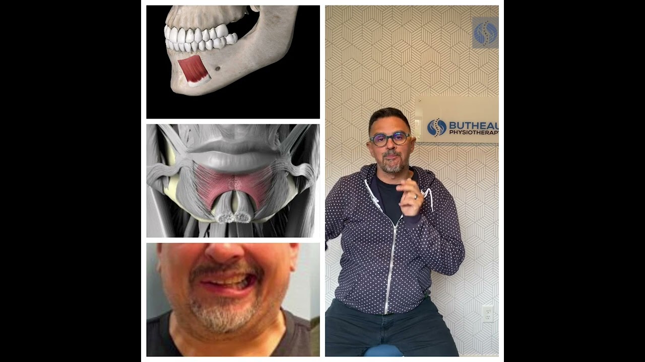 Bottom Lips Not Moving With Facial Paralysis? Check Your Depressor labii Inferioris