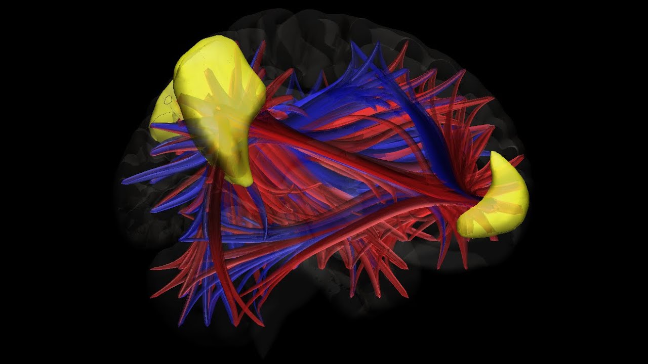 Functional connectivity of the Default Mode Network (DMN)