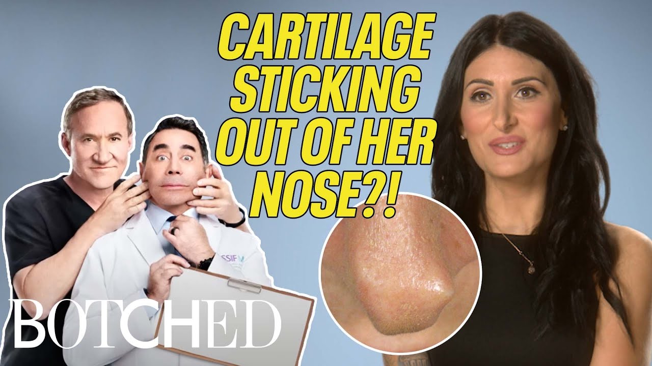 Edra's BOTCHED Nose Has Cartilage Sticking Out of the Tip?! (BEFORE & AFTER) | Botched | E!