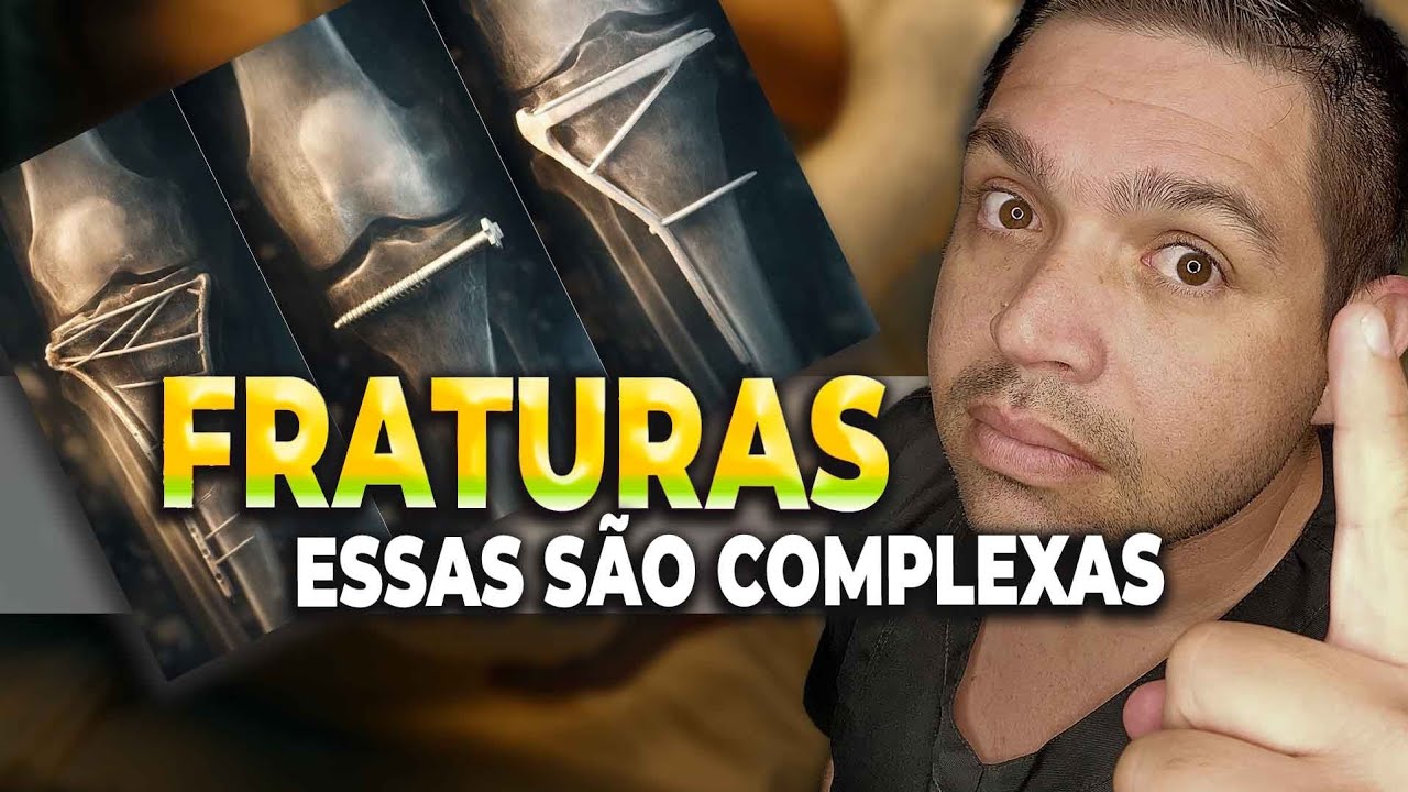 SIGA ESSAS ORIENTAÇÕES E SE RECUPERE DA SUA FRATURA