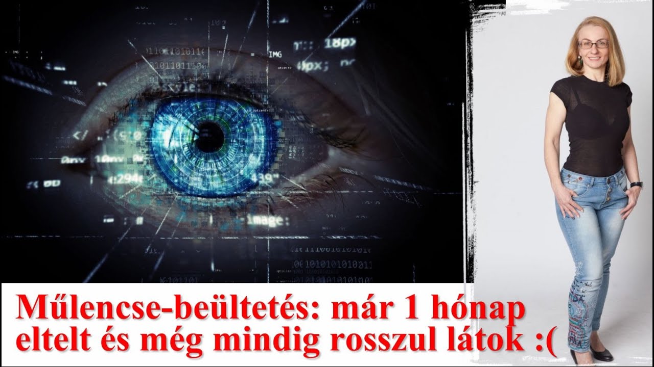 Mi van a maszattal? Trifok&aacute;lis műlencse be&uuml;ltet&eacute;s - 1 h&oacute;napos helyzet