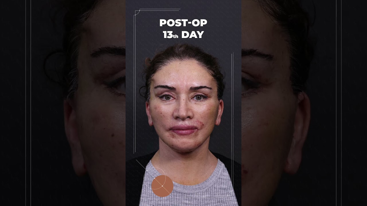Total Facial Rejuvenation
