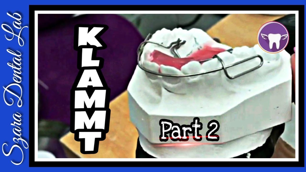 How to make a Klammt Activator Part 2 or 4 Wirebending Orthodontic appliance