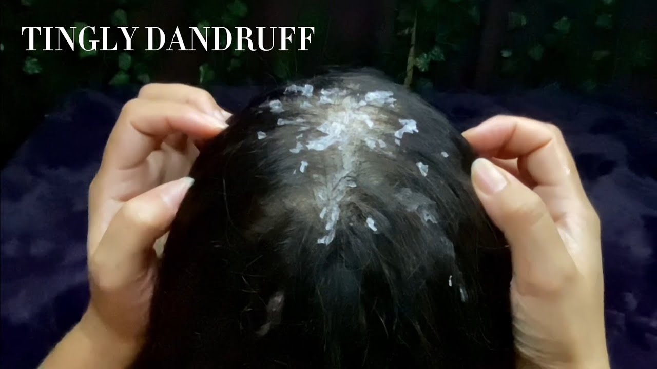 ASMR Super tingly, Dandruff Removal | No Talking 😴💤🥱
