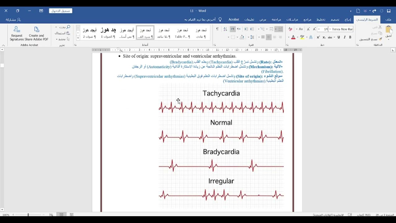 Cardiac Arrhythmias